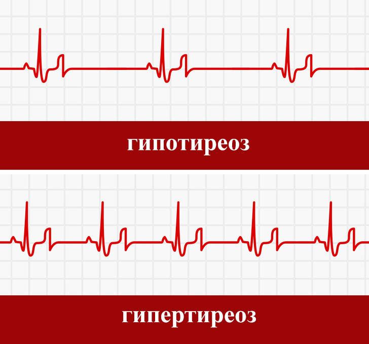 Изменение кардио частоты