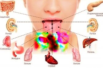 Специфические запахи болезней: узнаем о симптомах «по нюху»