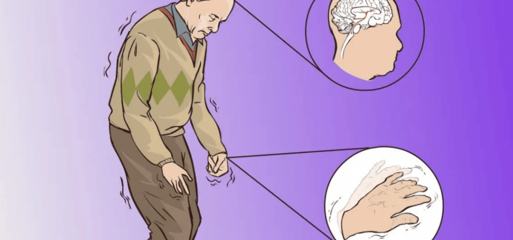 Предсказать деменцию можно за годы до постановки диагноза: три «тихих» симптома
